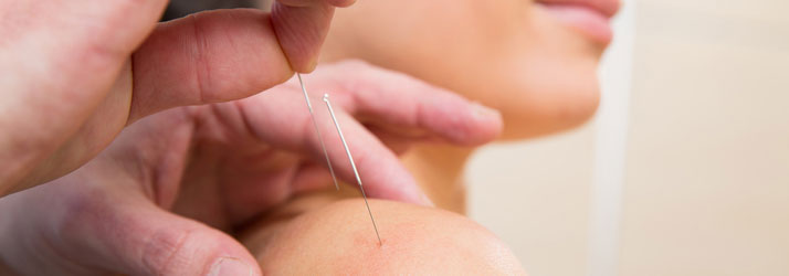 Chiropractic Tolland CT Acupuncture